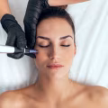 Exosomas faciales: regeneración avanzada y mejora de la calidad de la piel